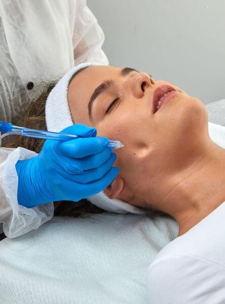 soin jet peel