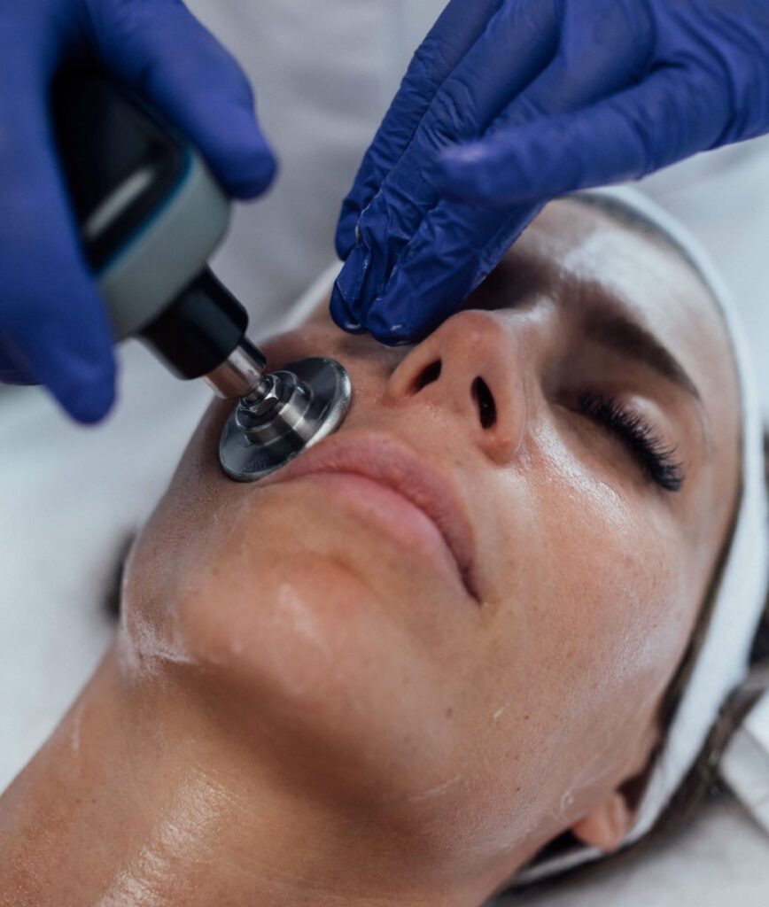 radiofrequence montpellier indiba lifting naturel